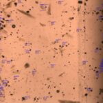 coccidiosis